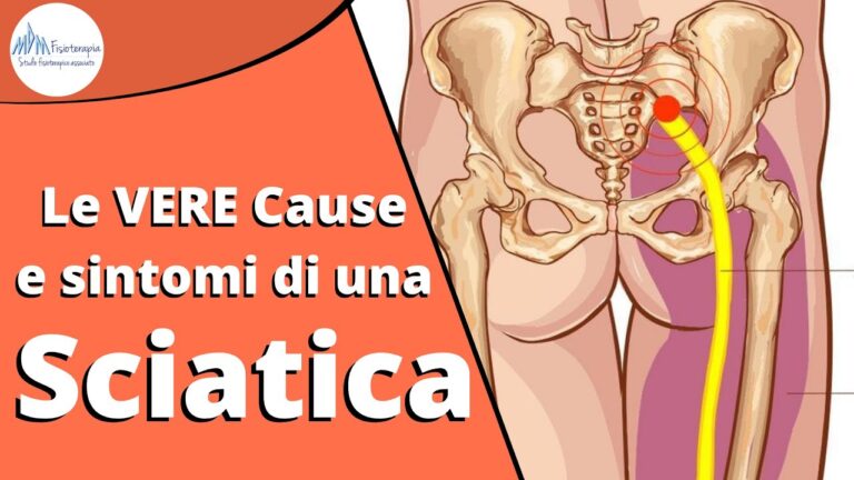 Calore improvviso alla gamba sinistra: cause e rimedi