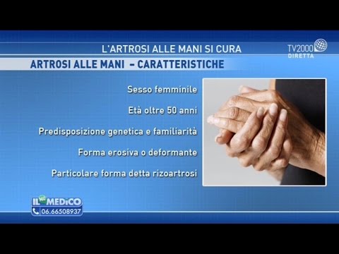 Radiografia mano: scoperta la chiave per diagnosticare e trattare l'artrosi