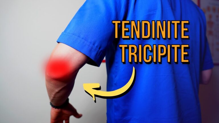 Addio ai dolori al tricipite: scopri i segreti per un braccio tonico in soli 5 minuti