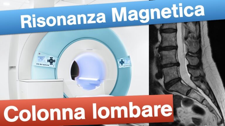 La risonanza magnetica della colonna vertebrale: guida completa
