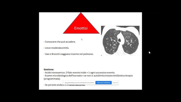 Cosa succede se smetti gli antibiotici? Scopri gli effetti sorprendenti!