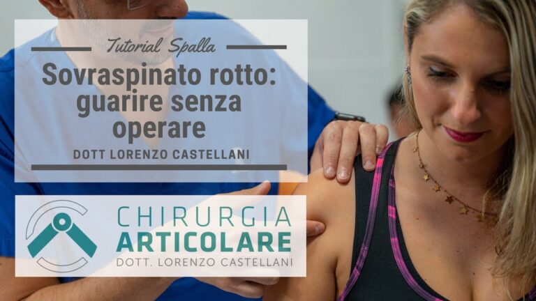 La sorprendente guarigione di una lesione parziale del sovraspinato: il segreto svelato