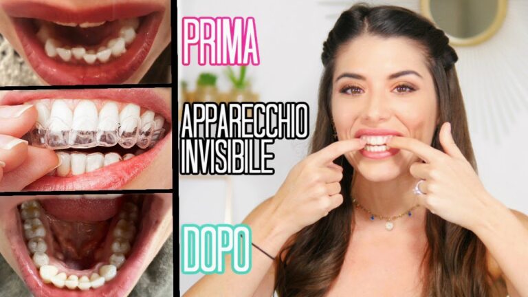 Mascherine per denti: il segreto sorriso impeccabile a portata di farmacia