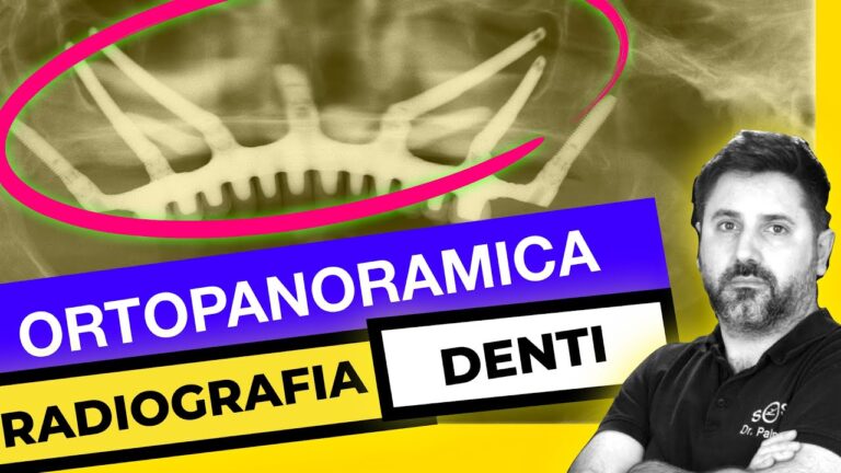 Ortopantomografia: scopri il prezzo conveniente per una diagnosi dettagliata!