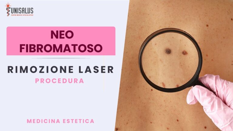 Neo con punto nero al centro: il segreto della perfezione