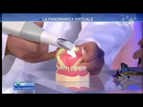 La dentiera senza palato: una soluzione ottimizzata e concisa