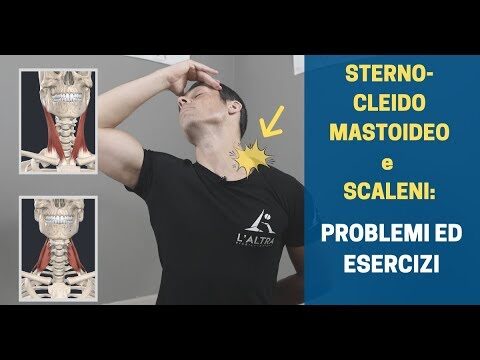 Sternocleidomastoideo infiammato: cause, sintomi e trattamenti
