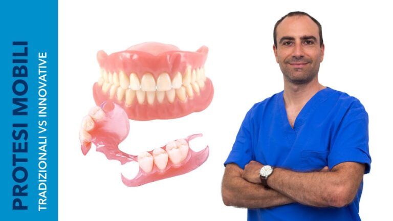 La rivoluzione delle dentiere mobili senza palato: comfort e estetica garantiti