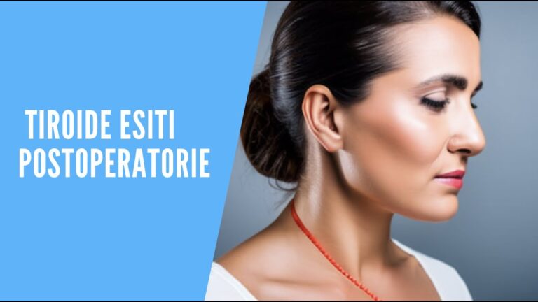 Risultati ottimizzati dopo intervento alla tiroide