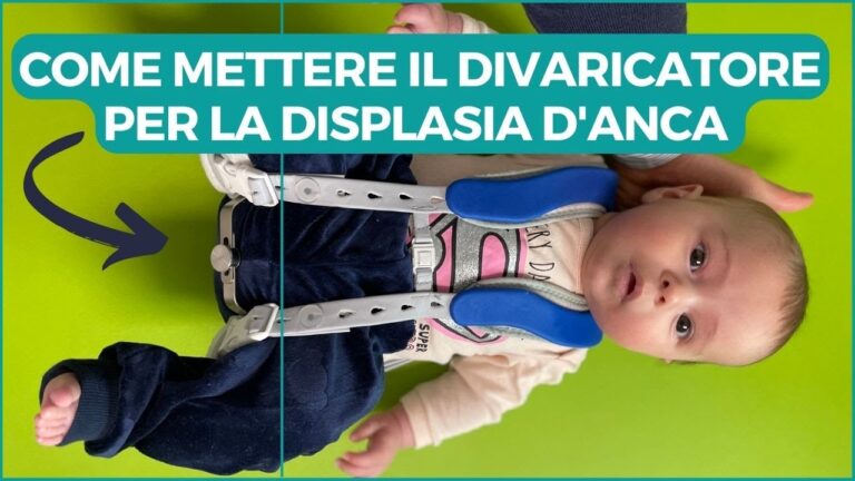 Divaricatore anche per neonati: la soluzione ottimizzata e compatta