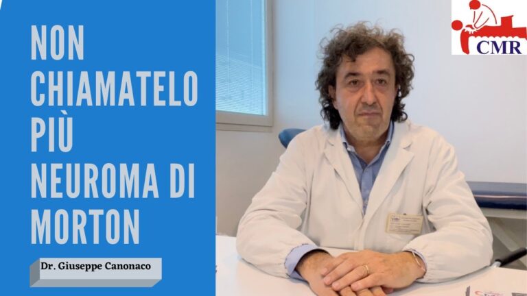 Come curare il neuroma di Morton con la pianta del piede
