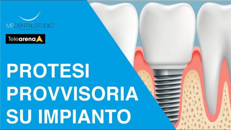 La Differenza Tra Protesi Provvisoria e Definitiva: Un'Analisi Ottimizzata