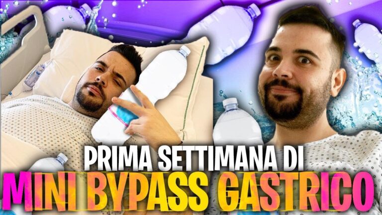 Mini Bypass Gastrico: Risultati Prima e Dopo