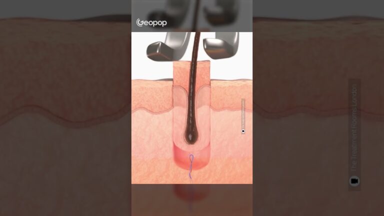 Bulbo Capelli al Microscopio: Un'Analisi Ottimizzata e Concisa