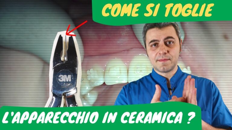 Guida all'uso del ceramica apparecchio fisso trasparente