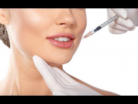 Rughe della marionetta: Il Botox come soluzione ottimale