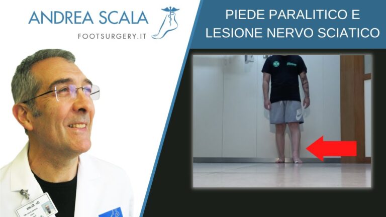 Recupero lesione nervo sciatico: guida ottimizzata