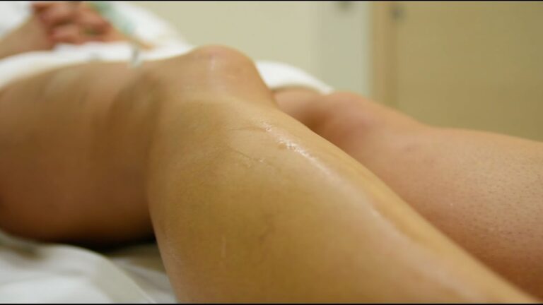 La Guida Definitiva alla Depilazione Totale dell'Inguine