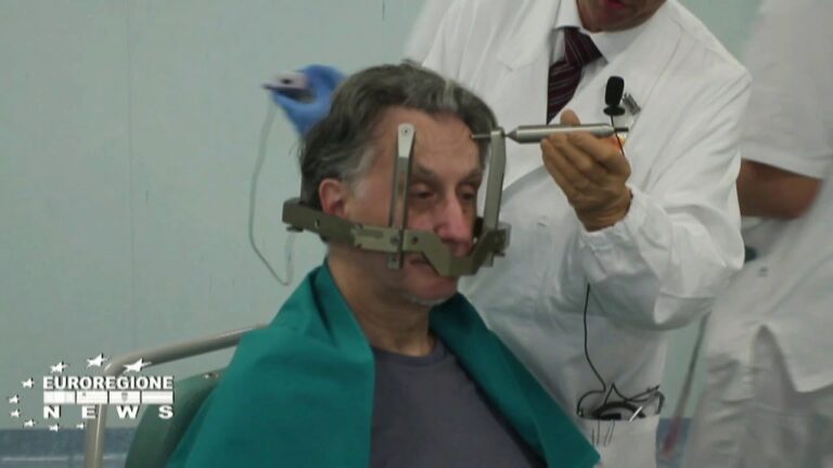 Effetti Collaterali della Radioterapia con Gamma Knife