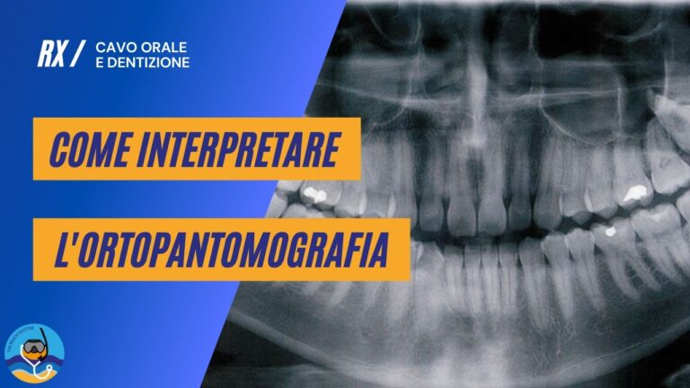 Optdentale: la chiave per un sorriso perfetto