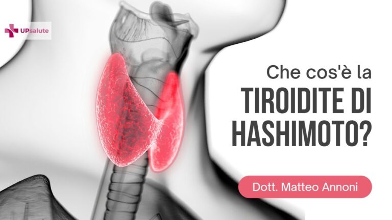 Differenze tra tiroidite di Hashimoto e morbo di Basedow