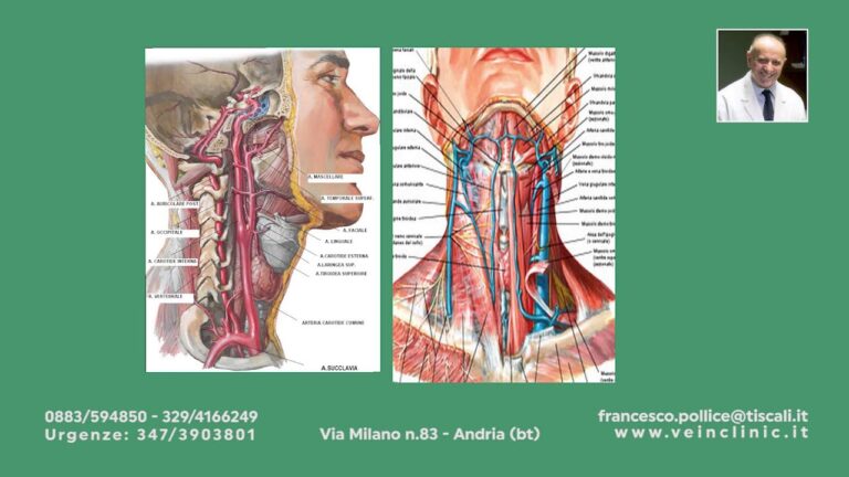 Clinica specializzata per ecocolordoppler tronchi sovraortici