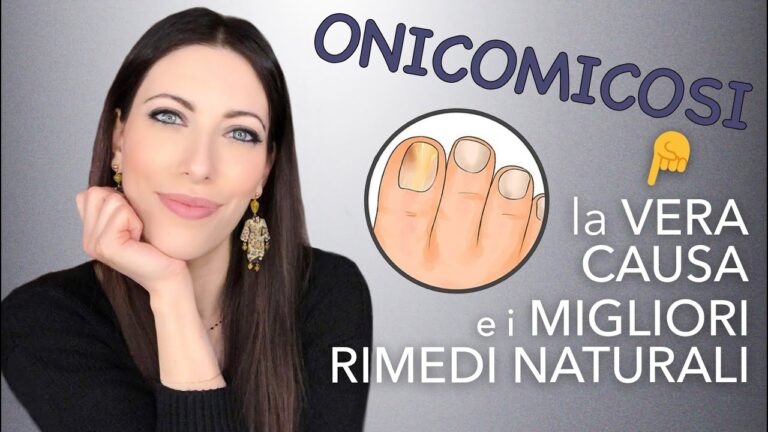 Pomata per Onicolisi: Trattamento Efficace e Veloce