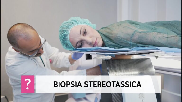 Mammotome: vantaggi dei clip in titanio nella biopsia al seno