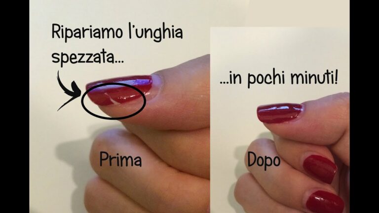 Rimedi naturali per unghia spezzata verticalmente