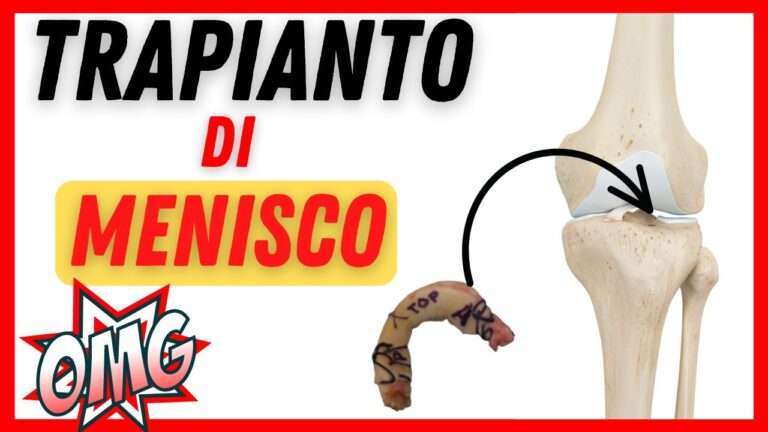 Protesi Menisco: Guida Completa all'Intervento