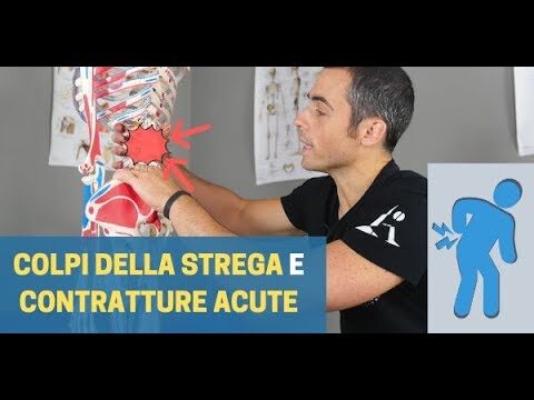 Colpo d'Aria alla Schiena: Cause, Sintomi e Trattamento
