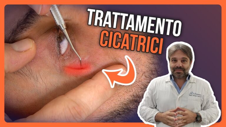 Guida all'utilizzo della crema per cicatrici da taglio