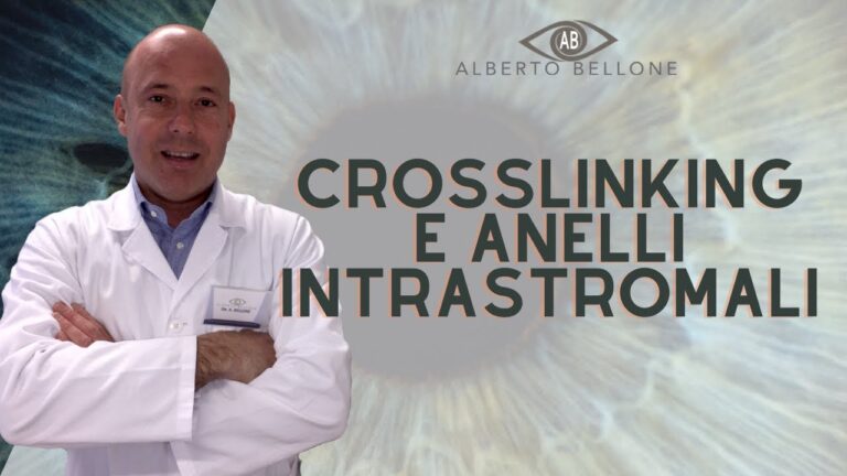 Cheratocono oltre i 40 anni: cosa sapere