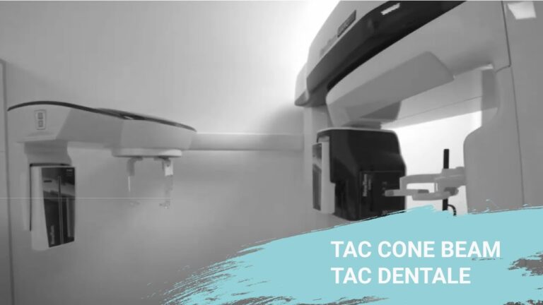Il costo ottimizzato del cono beam tac