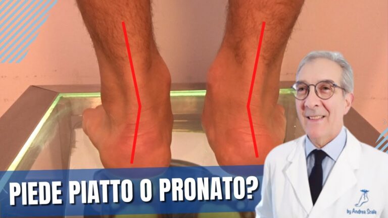 Piede Pronato Plantare: Cause, Sintomi e Trattamenti