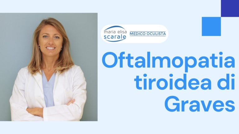 Sintomi oculari della tiroide: cosa sapere