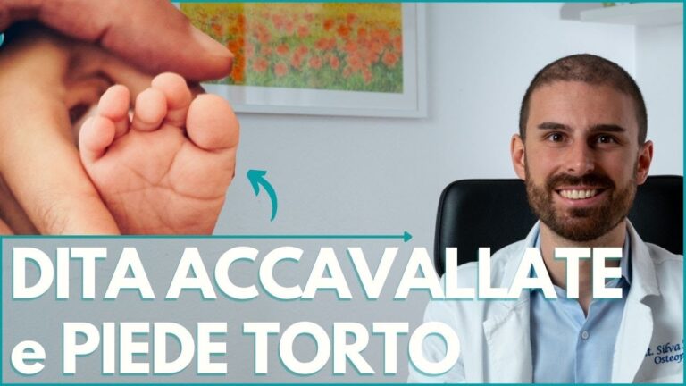 Accavallamento Dita dei Piedi: Cosa Rivelano sulla Tua Personalità