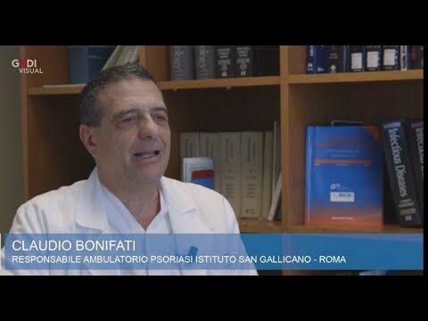 Il miglior smalto per psoriasi unghie: guida completa