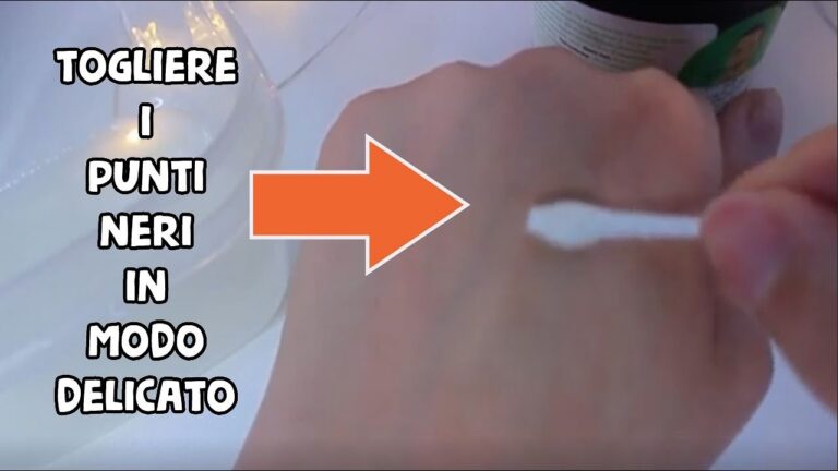 Rimedi efficaci per eliminare i punti neri dalle orecchie