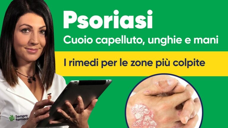 Psoriasi sulle Dita delle Mani: Cause, Sintomi e Trattamenti