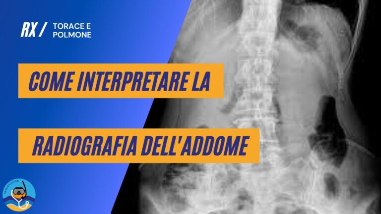 Guida alla Diagnosi per la Diretta Addome
