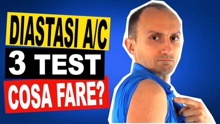 Artrosi dell'acromion clavicolare: cause e trattamenti