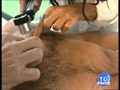La guida alla visita venereologica: tutto ciò che devi sapere