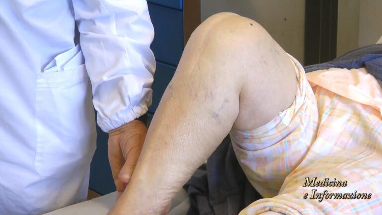 Complicanze tardive delle protesi d'anca: ottimizzazione e concisione