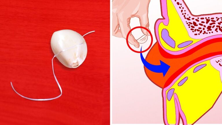 Aglio nell'ano: Benefici e Controversie
