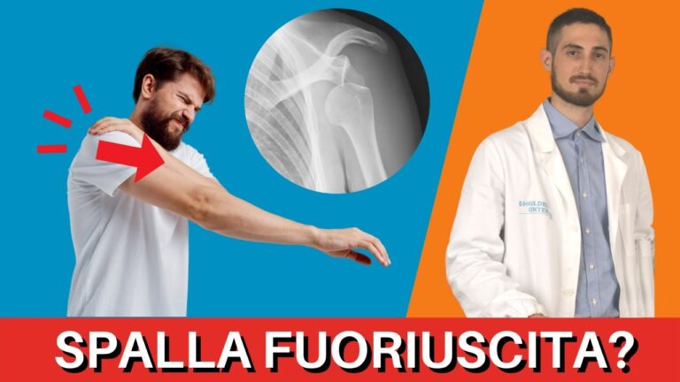 Guida alla sublussazione della spalla: cause, sintomi e trattamenti