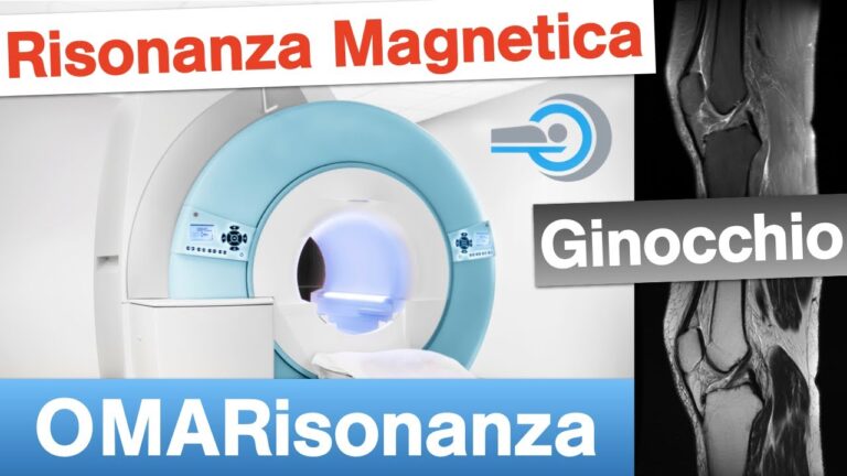 Costo Risonanza Magnetica Ginocchio: Guida Completa e Consigli Utili