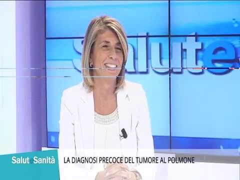 Tumore al torace: diagnosi tramite radiografia