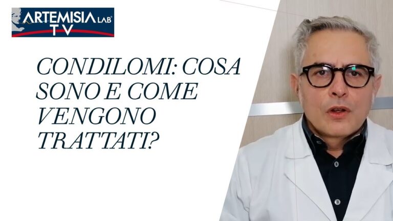 Condiloma Ano: Cause, Sintomi e Trattamenti