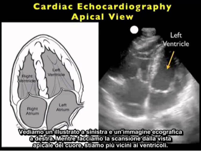 Ecografia Cardiaca: Guida Completa